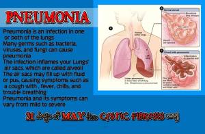 day14 pneumonia